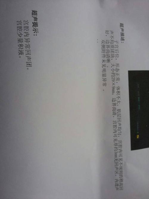 真球迷!鹿晗求实锤:桑切斯的树到底能不能下?【必一】(图1) b体育